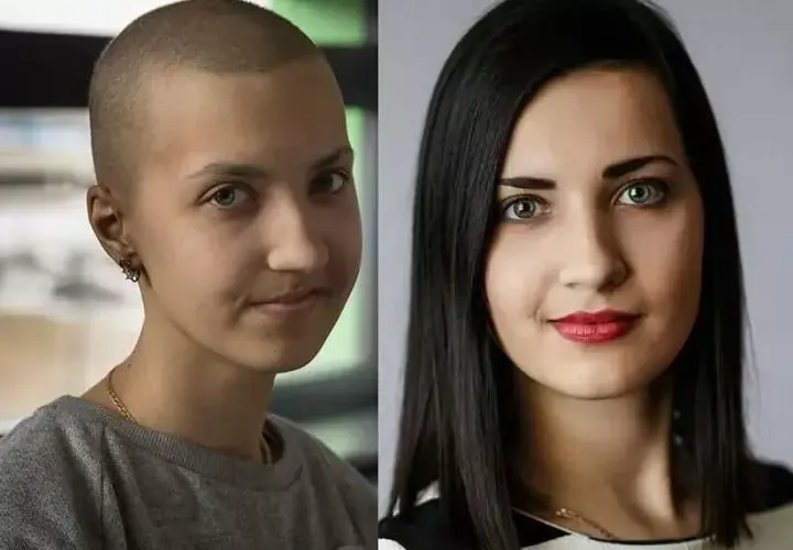 Po jakim czasie można farbować włosy po chemioterapii? Dowiedz się teraz!
